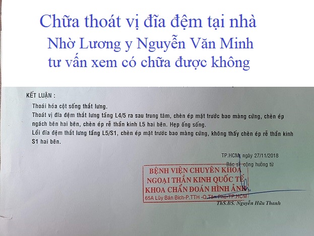 Chữa thoát vị đĩa đệm tại nhà